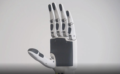 Intelligent artificial limb