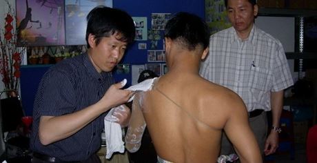 In 2007, he went to Malaysia to install prosthetics